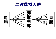 スライド11.JPG